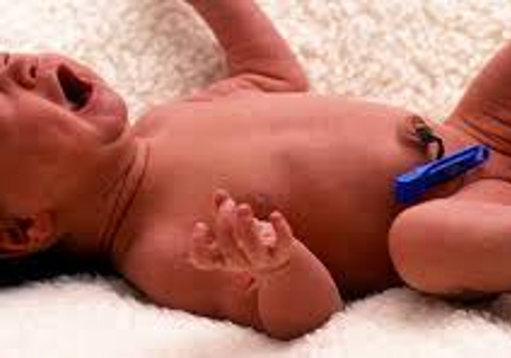 Ultimate Guide to Umbilical Cord Care for New Parents: Tips and Best Practices
