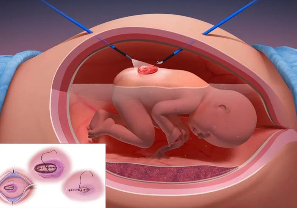 Prenatal Diagnosis and Surgical Planning for Congenital Anomalies: A Comprehensive Guide