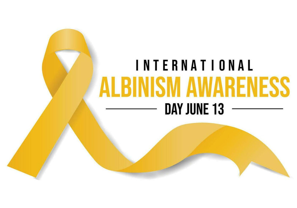 Celebrating Strength and Beauty: International Albinism Awareness Day