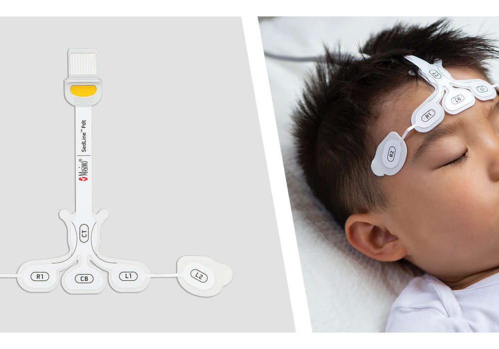 Real-time, Non-Invasive Brain Function Monitoring in Pediatrics
