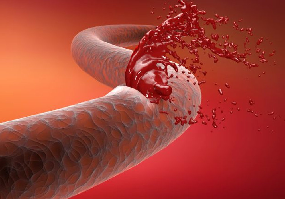 Embracing Care and Courage on World Haemophilia Day