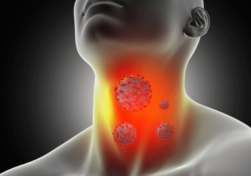 Understanding Chronic Pharyngitis in Children: Causes, Symptoms, and Treatment Options