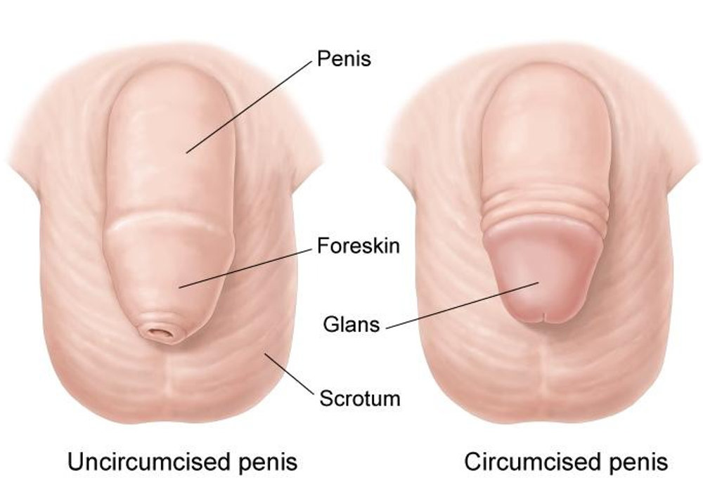 Understanding the Benefits and Considerations of Circumcision for Children