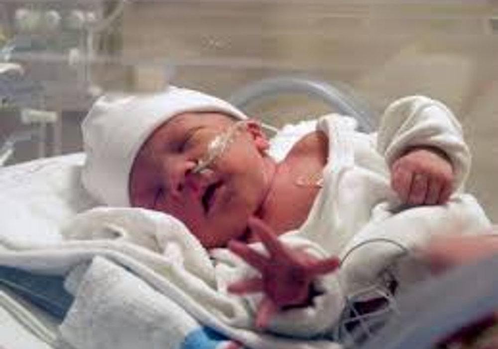 Understanding the Challenges of Extreme Prematurity: What Every Parent Should Know
