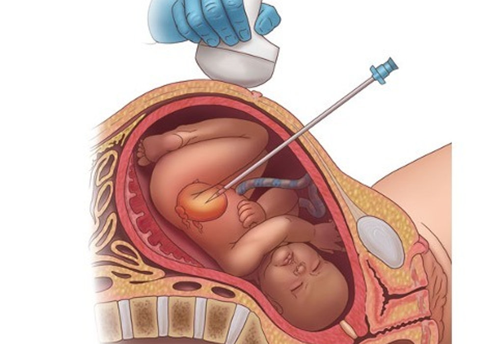 Exploring the Wondrous World of the Womb: Peek-a-boo and Beyond