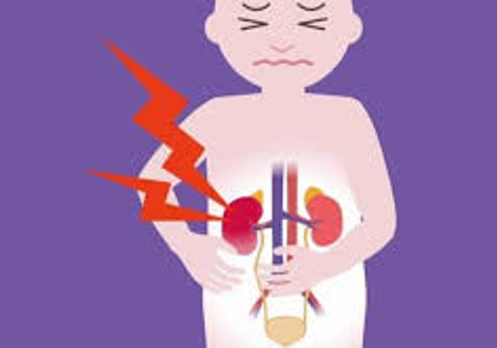 Navigating the Lifelines: Strategies for Managing Kidney Chaos