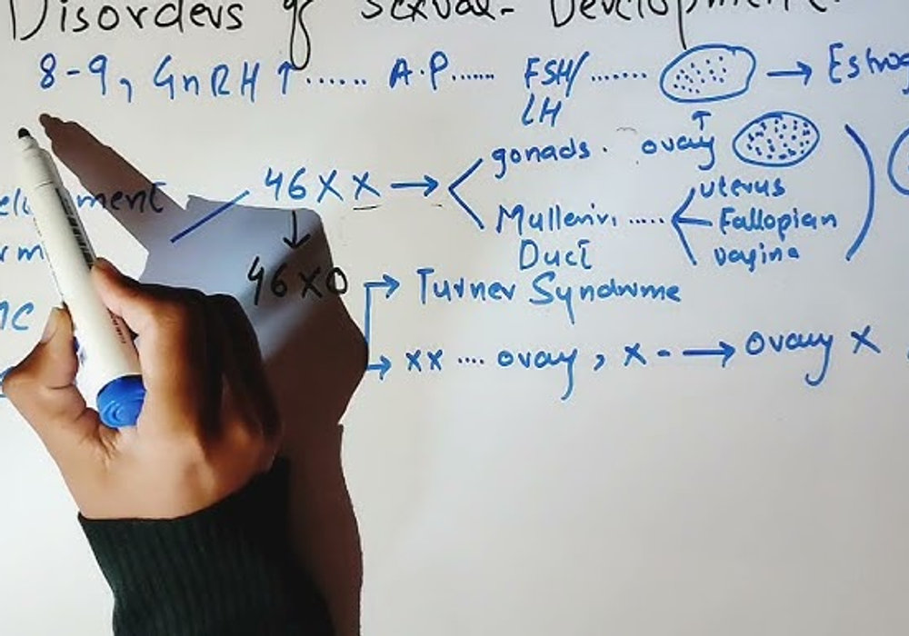 Navigating the rocky road of sexual development.